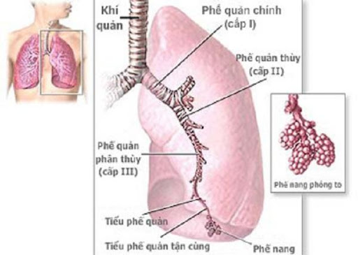 Hậu quả của phổi tắc nghẽn mãn tính 1