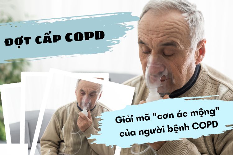 Đợt cấp COPD: Giải mã "cơn ác mộng" của người bệnh COPD